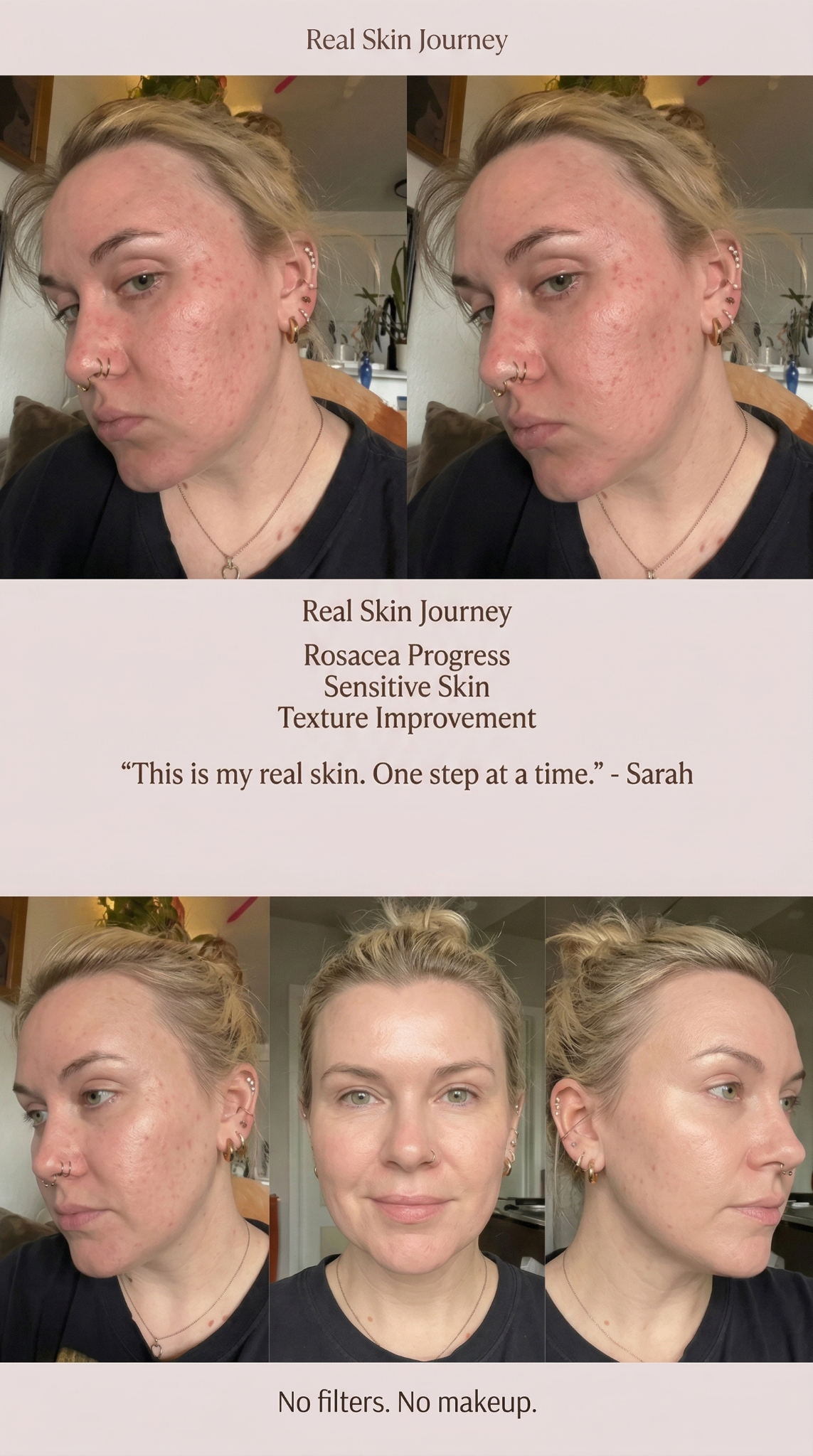 Calmara Barrier Reset Serum