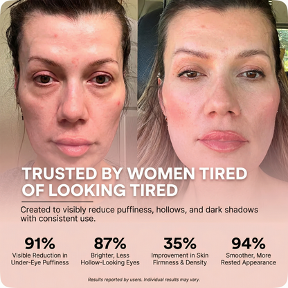 Lumera™ 2-in-1 Red Light + Microcurrent Eye Therapy